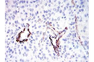 Immunohistochemistry (IHC) image for anti-Discs, Large (Drosophila) Homolog-Associated Protein 1 (DLGAP1) antibody (ABIN969175)