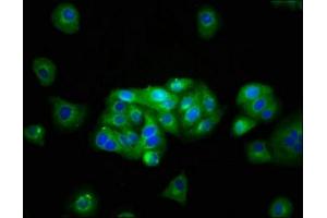 Immunofluorescence staining of HepG2 cells with ABIN7145017 at 1:133, counter-stained with DAPI. (KCNJ1 Antikörper  (AA 165-379))