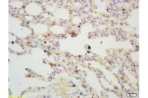 Formalin-fixed and paraffin embedded mouse lung labeled with Rabbit Anti TIGAR Polyclonal Antibody, Unconjugated (ABIN671286) at 1:200 followed by conjugation to the secondary antibody and DAB staining (TIGAR Antikörper  (AA 161-270))