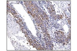 IHC analysis of DLGAP1 using anti-DLGAP1 antibody (ABIN7600257).