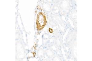 Immunohistochemistry of paraffin-embedded Rat kidney using using SMMHC/MYH11 antibody (ABIN7268745) at dilution of 1:8100 (40x lens).