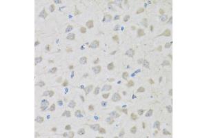 Immunohistochemistry of paraffin-embedded mouse brain using PENK antibody (ABIN5973724) at dilution of 1/100 (40x lens).