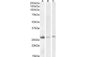 ABIN768557 (1 μg/mL) staining of Human Liver (A), Kidney (B) and -Mouse Liver (C) lysate (35 μg protein in RIPA buffer). (DNAJB9 Antikörper  (AA 61-75))