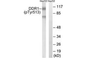 Western blot analysis of extracts from HepG2 cells treated with Na3VO4 0. (DDR1 Antikörper  (pTyr513))