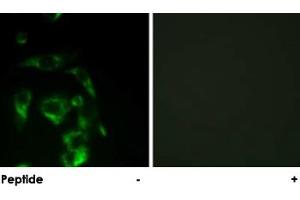 Immunofluorescence analysis of HeLa cells, using EIF4G1 polyclonal antibody . (EIF4G1 Antikörper)