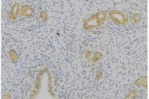 ABIN6276769 at 1/100 staining Human uterus tissue by IHC-P. (Prolactin Antikörper  (Internal Region))