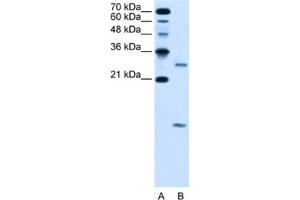 Western Blotting (WB) image for anti-Vacuolar H+-ATPase Homolog (VMA21) antibody (ABIN2463979) (VMA21 Antikörper)