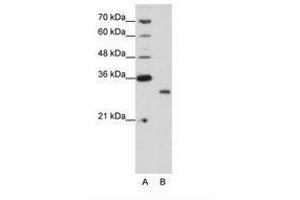 Image no. 1 for anti-CPX Chromosome Region, Candidate 1 (CPXCR1) (N-Term) antibody (ABIN202196) (CPXCR1 Antikörper  (N-Term))