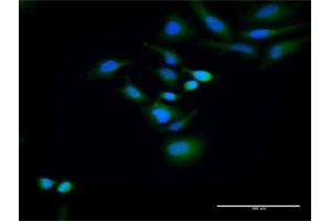 Immunofluorescence of purified MaxPab antibody to HOMER2 on HeLa cell. (HOMER2 Antikörper  (AA 1-343))