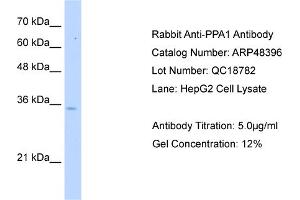 WB Suggested Anti-PPA1 Antibody   Titration: 5. (Pyrophosphatase (Inorganic) 1 (PPA1) (N-Term) Antikörper)
