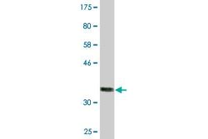 Western Blot detection against Immunogen (36. (Leptin Receptor Antikörper  (AA 31-130))