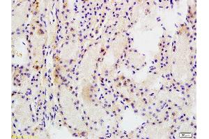 Formalin-fixed and paraffin embedded rat kidney tissue labeled Anti-MRP1 Polyclonal Antibody, Unconjugated  at 1:200, followed by conjugation to the secondary antibody and DAB staining (Multidrug-Resistance Like Protein 1 Antikörper  (AA 501-600))