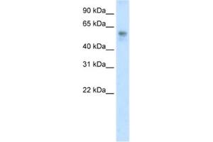 Western Blotting (WB) image for anti-BTB (POZ) Domain Containing 3 (BTBD3) antibody (ABIN2461861) (BTBD3 Antikörper)