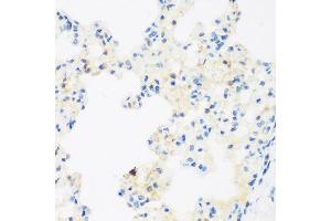 Immunohistochemistry of paraffin-embedded rat lung using NFU1 antibody at dilution of 1:200 (40x lens). (NFU1 Antikörper)