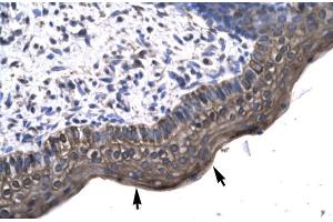 Human Spermatophore; KIN antibody - middle region in Human Spermatophore cells using Immunohistochemistry (KIN Antikörper  (Middle Region))