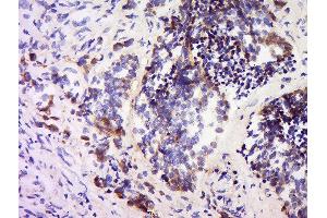 Immunohistochemistry (Paraffin-embedded Sections) (IHC (p)) image for anti-Secreted Protein, Acidic, Cysteine-Rich (Osteonectin) (SPARC) (AA 101-200) antibody (ABIN738141)