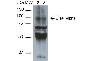 Western Blot analysis of Mouse Whole kidney homogenates showing detection of ~85kDa ENaC alpha protein using Mouse Anti-ENaC alpha Monoclonal Antibody, Clone 2G4 . (SCNN1A Antikörper  (AA 46-68) (PE))