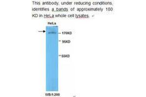 Image no. 1 for anti-Topoisomerase (DNA) II beta 180kDa (TOP2B) antibody (ABIN790819) (TOP2B Antikörper)