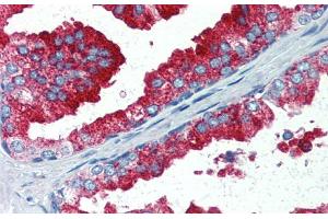 Immunohistochemistry with Human Prostate lysate tissue at an antibody concentration of 5. (YAP1 Antikörper  (C-Term))