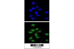 Confocal immunofluorescent analysis of AIRE Antibody with 293 cell followed by Alexa Fluor 488-conjugated goat anti-rabbit lgG (green). (AIRE Antikörper  (AA 64-92))