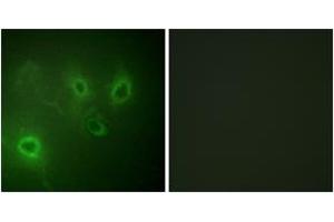 Immunofluorescence analysis of COS7 cells, using InsP3R1 (Ab-1598/1588) Antibody. (ITPR1 Antikörper  (AA 1566-1615))