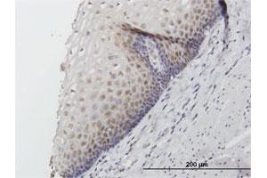 Immunohistochemistry (Formalin-fixed Paraffin-embedded Sections) (IHC (fp)) image for anti-FK506 Binding Protein 4, 59kDa (FKBP4) (AA 1-459) antibody (ABIN515666)