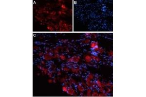 Expression of TRPV4 in rat DRG - Immunohistochemical staining of rat dorsal root ganglion (DRG) frozen sections using Anti-TRPV4 (extracellular) Antibody (ABIN7043852, ABIN7044071 and ABIN7044072). (TRPV4 Antikörper  (3rd Extracellular Loop))