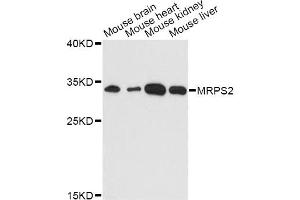 Western blot analysis of extracts of various cell lines, using MRPS2 antibody (ABIN6293851) at 1:3000 dilution. (MRPS2 Antikörper)