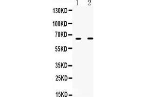 Western blot analysis of IFNAR1 expression in HELA whole cell lysates ( Lane 1) and NIH3T3 whole cell lysates ( Lane 2).