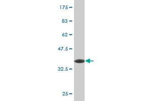 Western Blot detection against Immunogen (37. (SNAIL Antikörper  (AA 121-230))