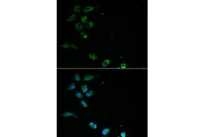 Immunofluorescence analysis of MCF-7 cells using HFE antibody. (HFE Antikörper)
