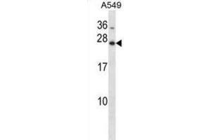 Western Blotting (WB) image for anti-Homeobox B7 (HOXB7) antibody (ABIN2998352)