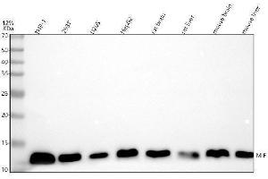 Western blot analysis of MIF using anti-MIF antibody (ABIN7605560).