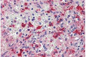 Spleen, Human: Formalin-Fixed, Paraffin-Embedded (FFPE) (HMOX1 Antikörper)