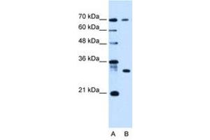 Image no. 1 for anti-ATPase, H+ Transporting, Lysosomal Accessory Protein 1-Like (ATP6AP1L) (C-Term) antibody (ABIN6736678) (ATP6AP1L Antikörper  (C-Term))