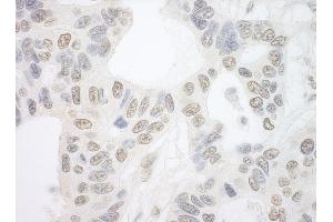 anti-PRP6 Pre-mRNA Processing Factor 6 Homolog (PRPF6) (AA 150-200) antibody