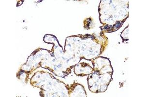 Immunohistochemistry of paraffin-embedded Human placenta using HSD17B1 Polyclonal Antibody at dilution of 1:100 (40x lens). (HSD17B1 Antikörper)