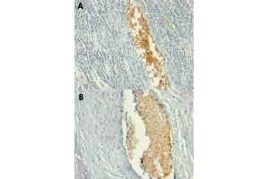 Immunohistochemical staining (Formalin-fixed paraffin-embedded sections) of human tonsil (A) and human placenta (B) with AMPD3 monoclonal antibody, clone AMPD3/901 . (AMPD3 Antikörper)
