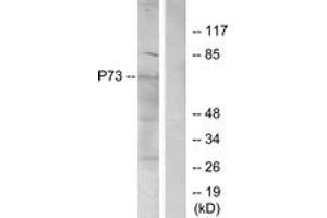 Western blot analysis of extracts from K562 cells, using p73 (Ab-99) Antibody. (Tumor Protein p73 Antikörper  (AA 66-115))