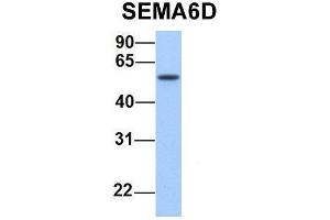 Host:  Rabbit  Target Name:  SEMA6D  Sample Type:  Human Fetal Lung  Antibody Dilution:  1. (SEMA6D Antikörper  (N-Term))