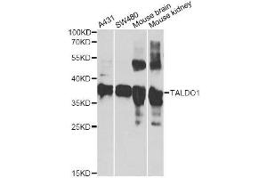Western blot analysis of extracts of various cell lines, using TALDO1 antibody. (TALDO1 Antikörper  (AA 1-337))