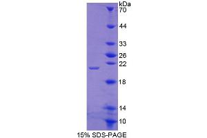 SDS-PAGE (SDS) image for Integrin beta-8 (ITGB8) (AA 471-629) protein (His tag) (ABIN6238944) (ITGB8 Protein (AA 471-629) (His tag))