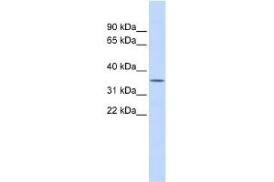 WB Suggested Anti-FCN1 Antibody Titration: 0. (FCN1 Antikörper  (Middle Region))
