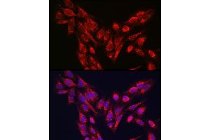 Immunofluorescence analysis of U-2 OS cells using PINK1 Rabbit pAb (ABIN6128457, ABIN6145665, ABIN6145667 and ABIN6215214) at dilution of 1:250 (40x lens). (PINK1 Antikörper  (AA 282-581))