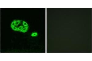 Immunofluorescence analysis of NIH-3T3 cells, using PI3-kinase p85-alpha/gamma (Phospho-Tyr467/199) Antibody. (PI3K p85 alpha/gamma Antikörper  (pTyr467))