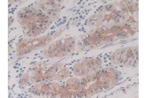 IHC-P analysis of Human Stomach Tissue, with DAB staining. (IL-8 Antikörper  (AA 23-101))