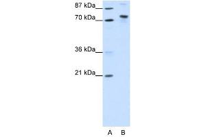 KIAA0737 antibody (20R-1215) used at 0. (TOX4 Antikörper  (N-Term))