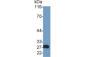 Detection of GZMA in Rat Kidney lysate using Polyclonal Antibody to Granzyme A (GZMA) (GZMA Antikörper  (AA 29-260))