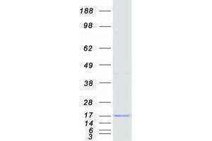 Ubiquitin-Conjugating Enzyme E2W (UBE2W) (Transcript Variant 2) protein (Myc-DYKDDDDK Tag)