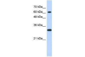WB Suggested Anti-ERF Antibody Titration:  0. (ERF Antikörper  (Middle Region))
